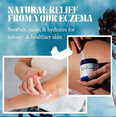 The Ocean Healed My Eczema Soothing Cream